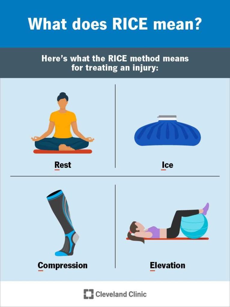What Are The Steps In The Rice Method A Simple Guide